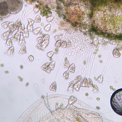 Vorticellidae