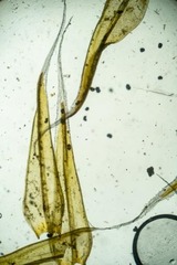 Racomitrium lanuginosum