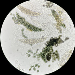 Podospora collapsa