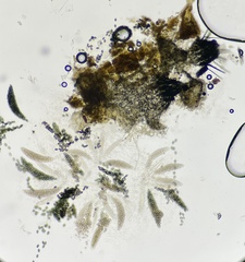Podospora collapsa
