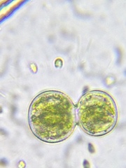 Cosmarium contractum