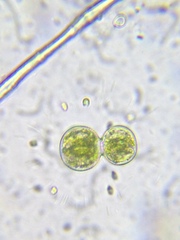 Cosmarium contractum