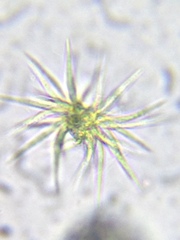 Ankistrodesmus densus