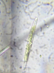 Closterium acerosum
