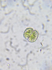 Cosmarium punctulatum