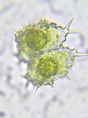 Staurastrum hystrix