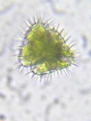 Staurastrum hystrix