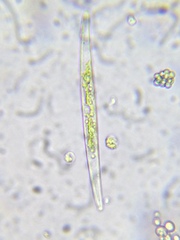 Closterium acerosum