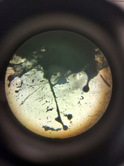 Aspergillus