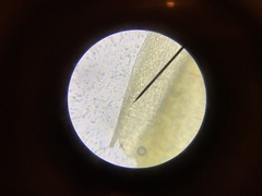 Grimmia trichophylla