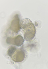 Chytridiomycota