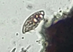 Paramecium