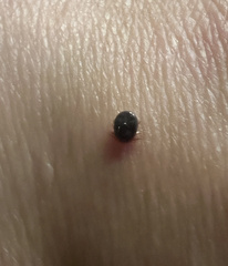 Ixodidae