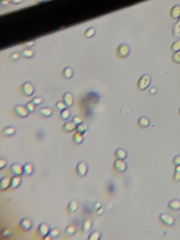 Saccharomyces cerevisiae