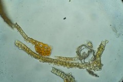 Schistidium papillosum