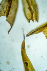 Schistidium papillosum