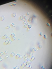 Saccharomyces cerevisiae