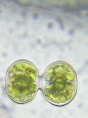 Cosmarium contractum