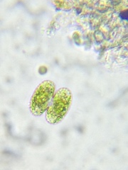 Cosmarium punctulatum