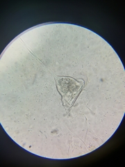 Vorticella campanula