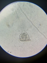 Vorticella campanula