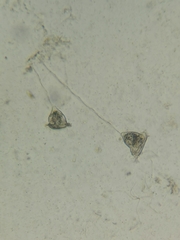 Vorticella campanula