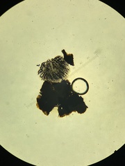 Podospora anserina