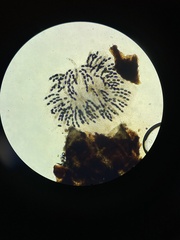 Podospora anserina