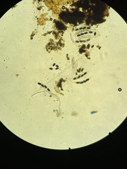 Podospora anserina