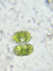 Staurastrum polytrichum