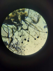 Aspergillus