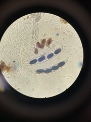Podospora anserina
