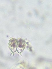 Staurastrum avicula
