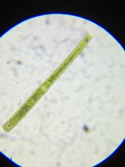 Pleurotaenium verrucosum