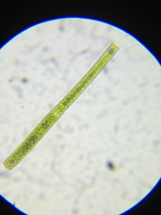 Pleurotaenium verrucosum