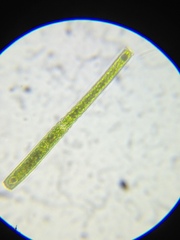 Pleurotaenium verrucosum