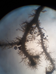 Eotrichocolea polyacantha