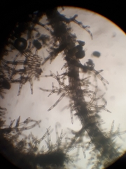 Eotrichocolea polyacantha