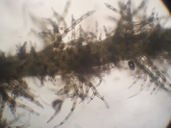 Eotrichocolea polyacantha