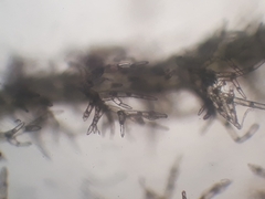 Eotrichocolea polyacantha