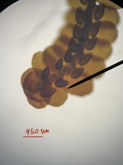 Frullania capensis