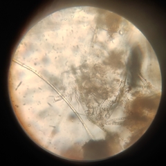 Arthropoda