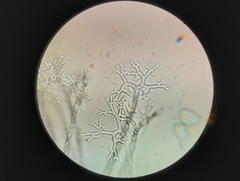 Erysiphe berberidis