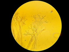 Erysiphe berberidis