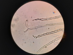Erysiphe berberidis