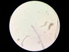 Erysiphe berberidis