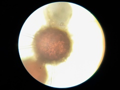 Erysiphe berberidis
