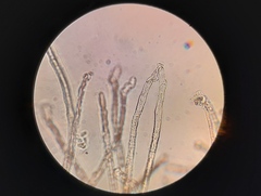 Erysiphe berberidis