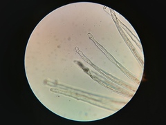 Erysiphe berberidis