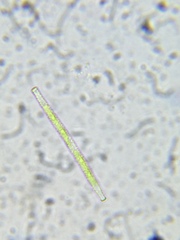 Gonatozygon brebissonii